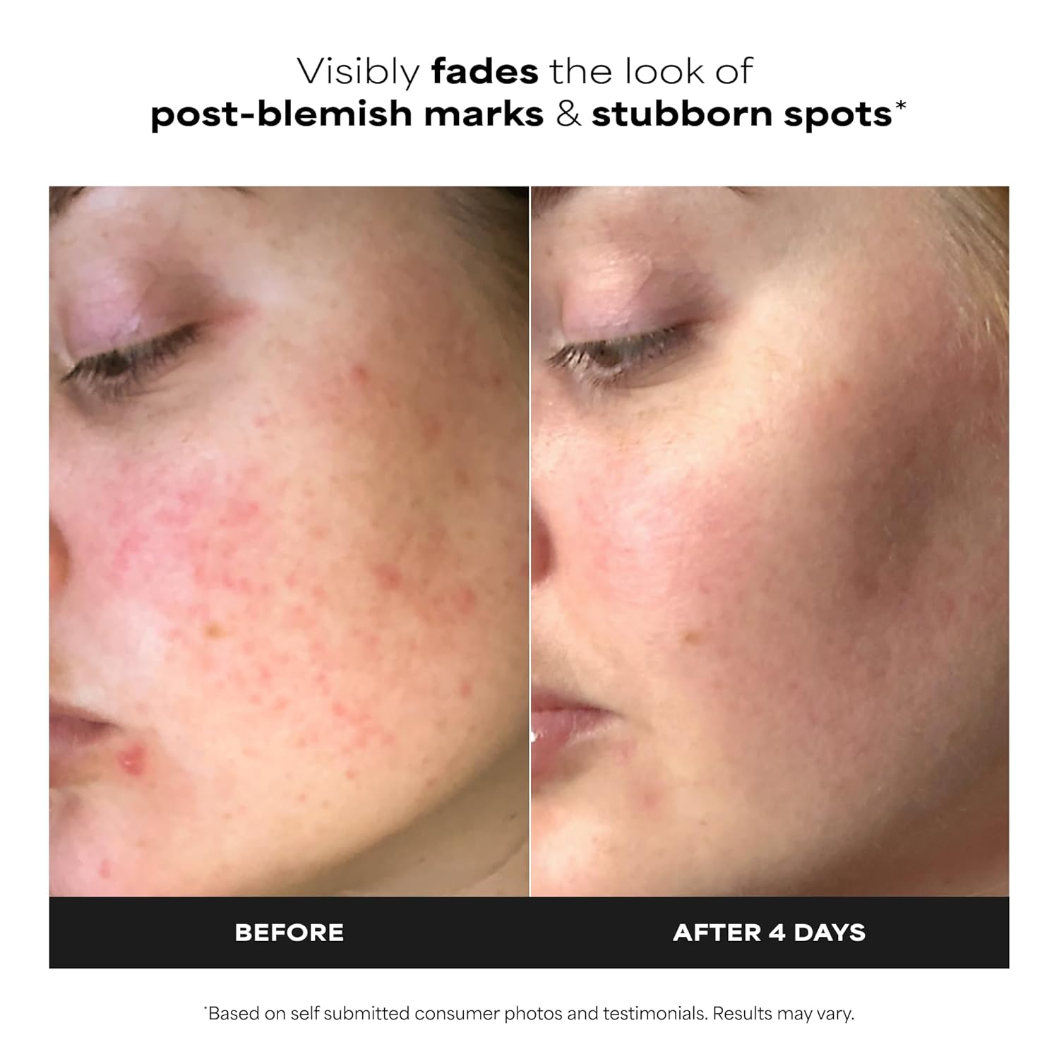 Paula's Choice BOOST 10% Azelaic Acid Booster Cream Gel Face Serum with Salicylic Acid