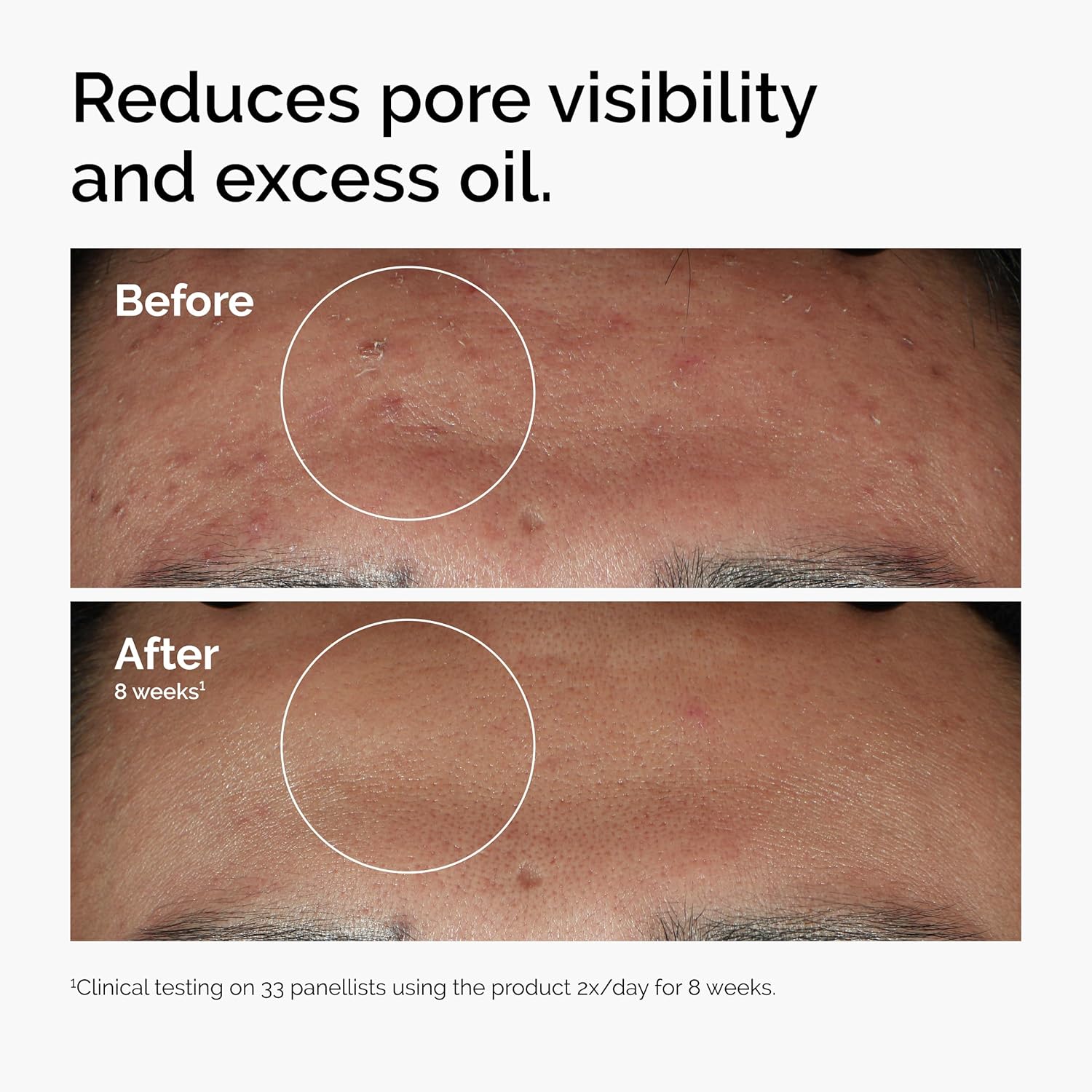 5% vs. 10% vs. 20% Niacinamide: Which Concentration Actually Moves the Needle on Dark Spots